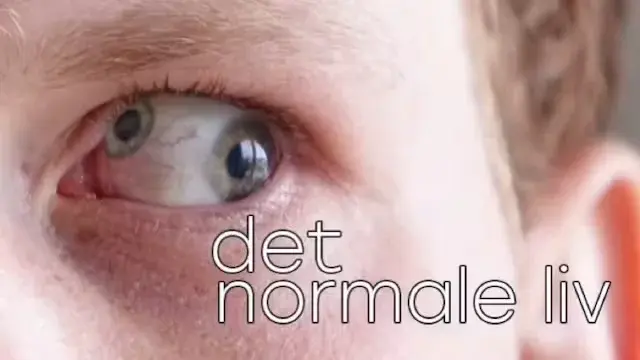DET NORMALE LIV